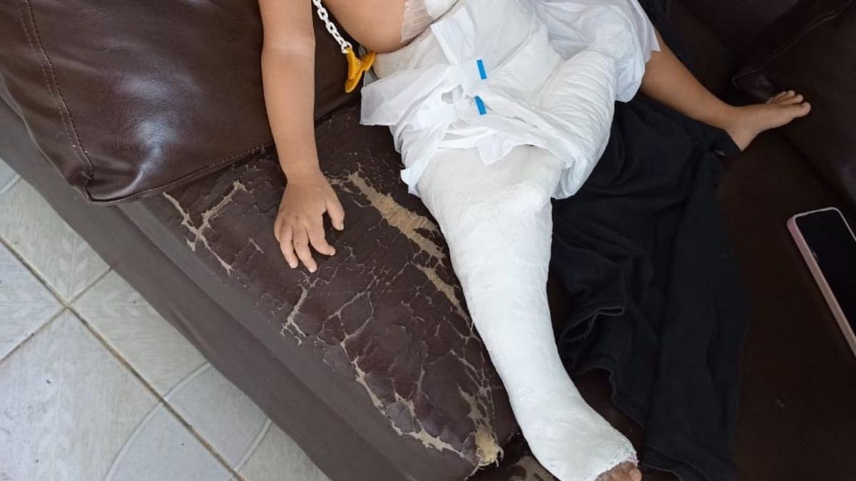 familia denuncia mae apos crianca de 1 ano sofrer fratura na perna em manaus foto arquivo pessoal