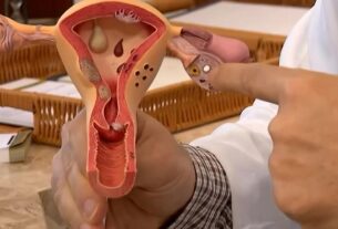 verdeescuro 1